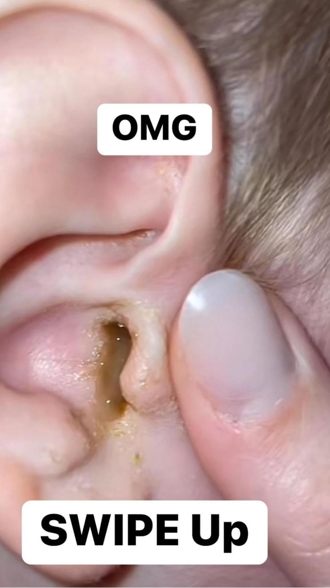 Ear Infection: 6 Signs You Have It