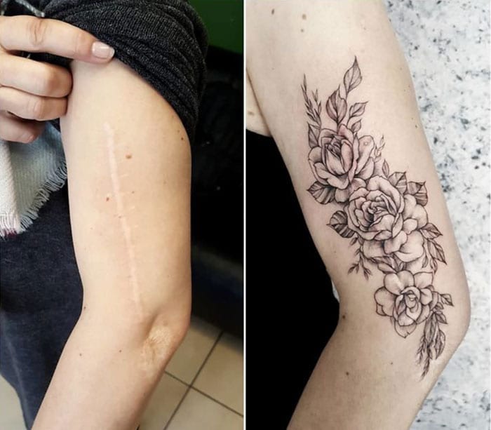 Tattoos Can Help You Turn Scars Into Something Beautiful