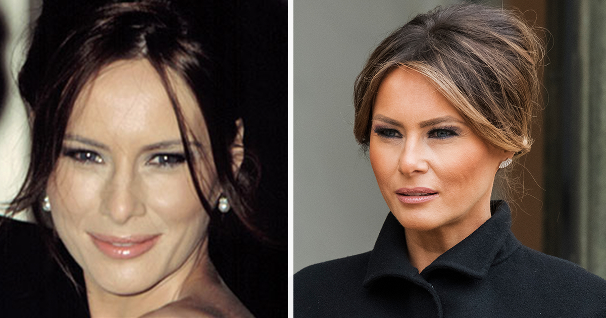 Melania Trump breaks silence on plastic surgery rumors and it confirms what we suspected
