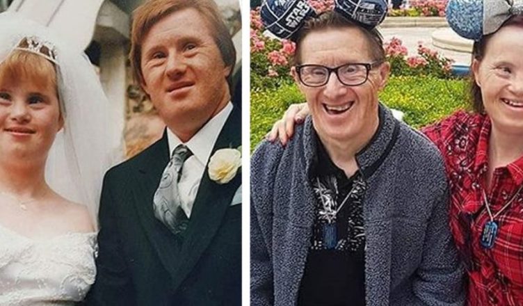 People Were Against Their Relationship: A Down’s Syndrome Couple Married and is Already 25 Years Happy Together!