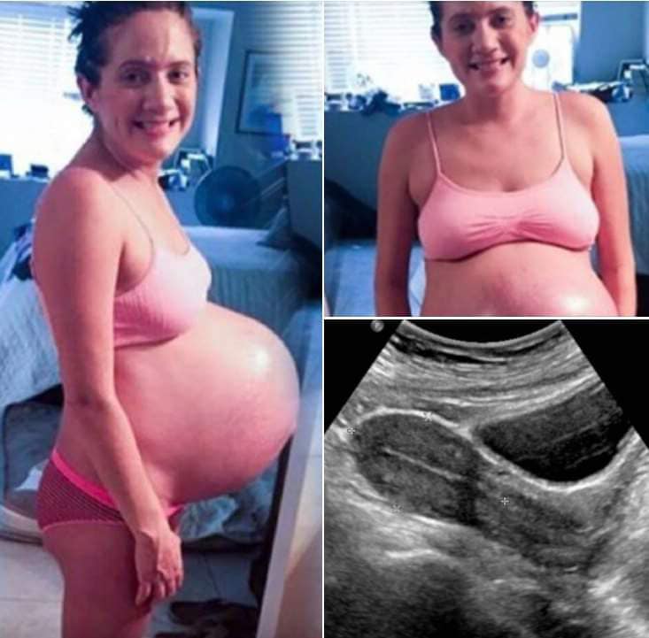 Mom who struggled with infertility shares her roller coaster story